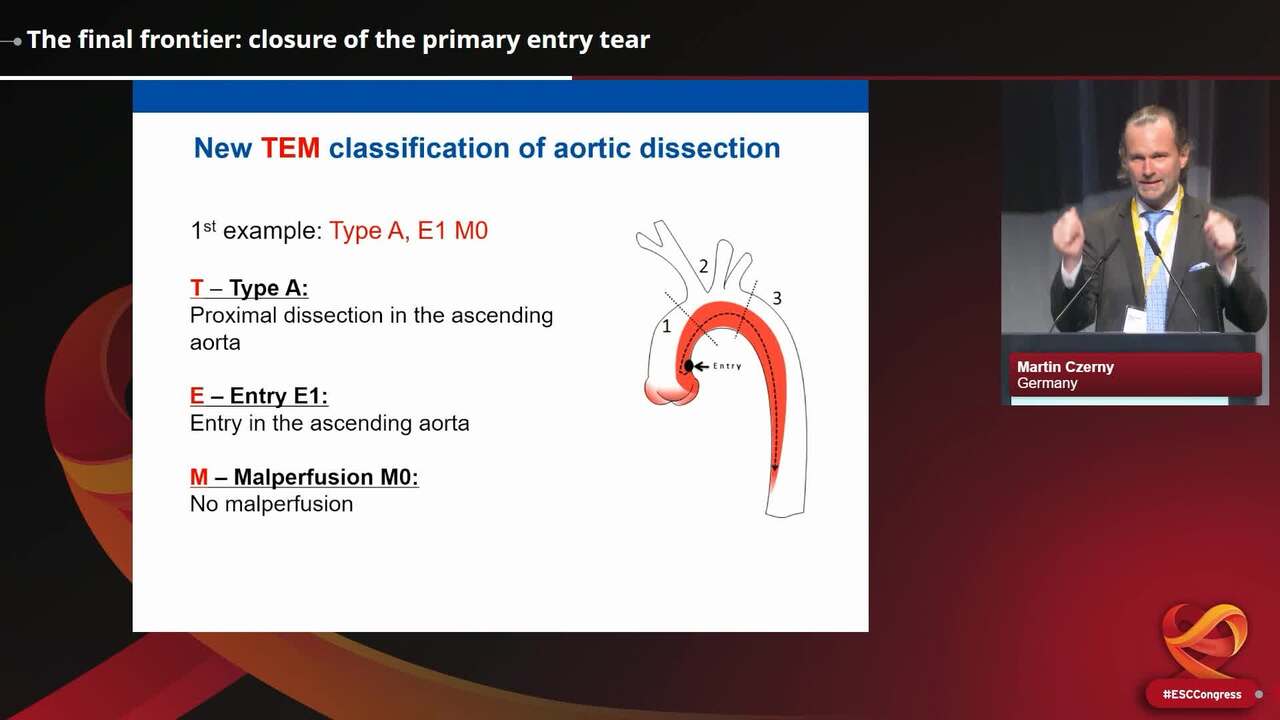 The final frontier: closure of the primary entry tear