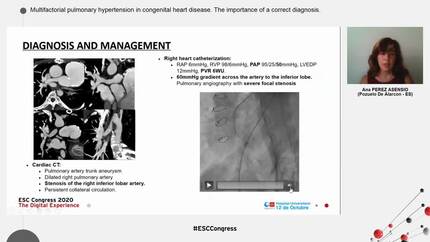 Multifactorial pulmonary hypertension in congenital heart disease. The importance of a correct diagnosis.