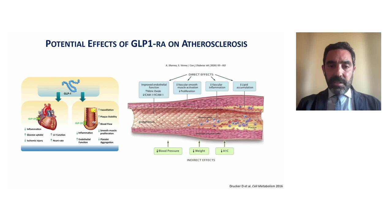 Diabetes and ACS - enhancing post-discharge outcomes after primary PCI
