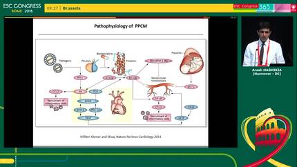 Peri-partum cardiomyopathy - Clinical case