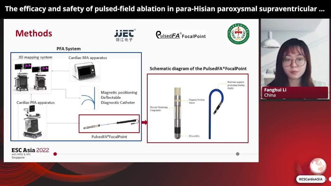 Esc 365 The Efficacy And Safety Of Pulsed Field Ablation In Para Hisian Paroxysmal