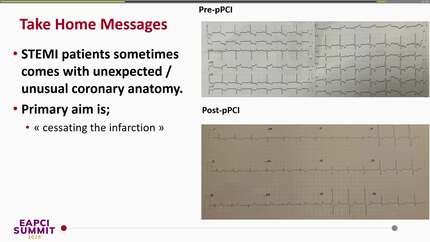 Dynamic strategy shifts in a post-CABG STEMI: lessons in adaptation