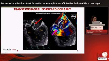 Presentation thumbnail