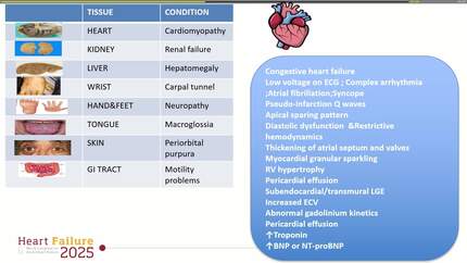 Unmasking AL(ligth chain) amyloidosis in a patient with heart failure and syncope: a comprehensive diagnostic journey