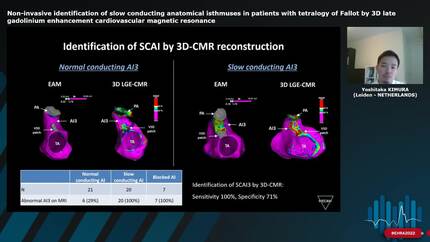 Non-invasive identification of slow conducting anatomical isthmuses in patients with tetralogy of Fallot by 3D late gadolinium enhancement cardiovascular magnetic resonance