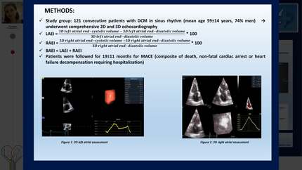 Three dimensional biatrial expansion index as an independent predictor of outcome in dilated cardiomyopathy
