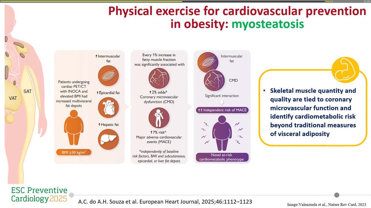 Obesity as a cardiovascular disease: integrated management 