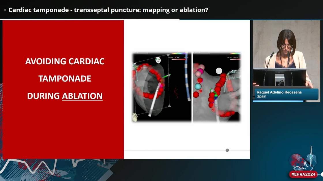 ESC 365 - Cardiac tamponade - transseptal puncture: mapping or ablation?