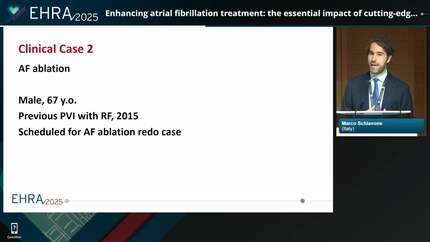 Enhancing atrial fibrillation treatment: the essential impact of cutting-edge signal recording and mapping technologies