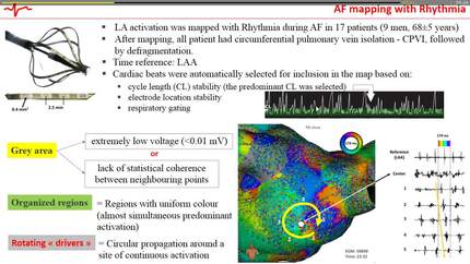 Sequential ultra-high density contact mapping shows increase of left atrial organization during persistent atrial fibrillation ablation