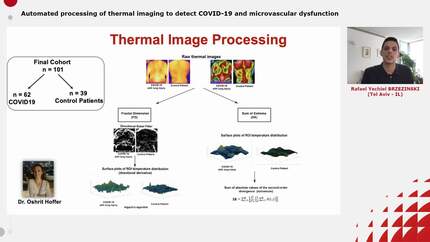 Automated processing of thermal imaging to detect COVID-19 and microvascular dysfunction 