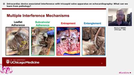 Presentation thumbnail
