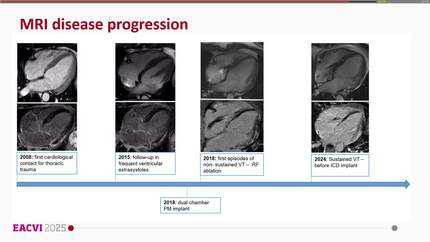 Presentation thumbnail