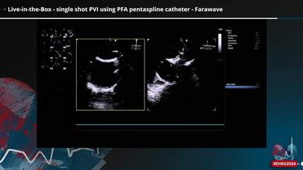 Live-in-the-Box - strive for perfection