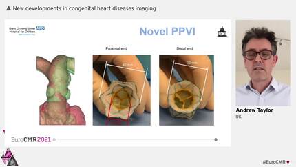New developments in congenital heart diseases imaging  