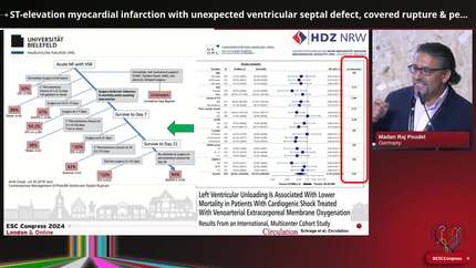 ST-elevation myocardial infarction with unexpected ventricular septal defect, covered rupture & pericardial tamponade managed by combined percutaneous circulatory support as bridge to surgical repair