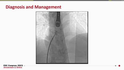 Presentation thumbnail