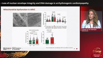 Loss of nuclear envelope integrity and DNA damage in arrhythmogenic cardiomyopathy