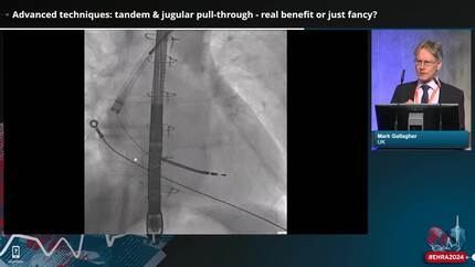 Lead extraction 2024 - achieving excellence beyond simple extraction