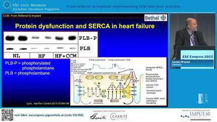 Cardiac contractility modulation: a proven device-based therapeutic approach to reduce hospitalizations and improve quality of life for patients with heart failure