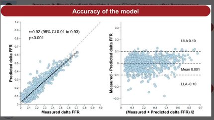 Impact of pullback pressure gradient on clinical outcomes after percutaneous coronary interventions