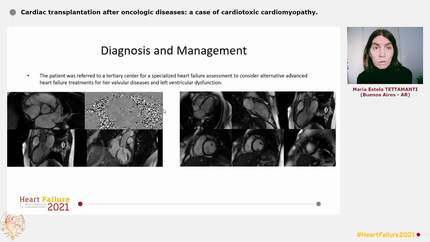 Presentation thumbnail