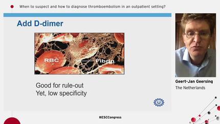 When to suspect and how to diagnose thromboembolism in an outpatient setting?