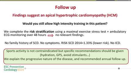 Should we continue screening assymptomatic athletes after becoming master?   A late presentation of hypertrofic cardiomyopathy case report