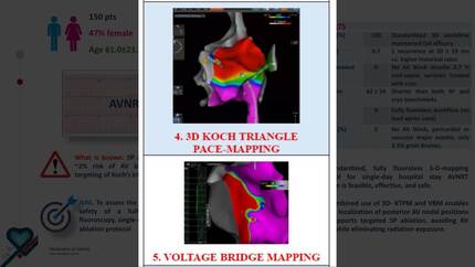 A standardized low-fluoro approach to perform atrio-ventricular nodal re-entrant tachycardia ablation. PICENO AVNRT.