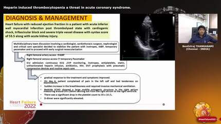 Heparin induced thrombocytopenia  a threat in acute coronary syndrome.