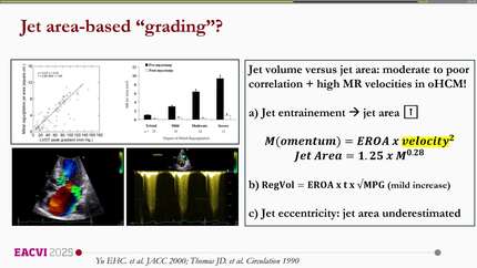 Beyond the obstruction: mitral regurgitation in hypertrophic cardiomyopathy