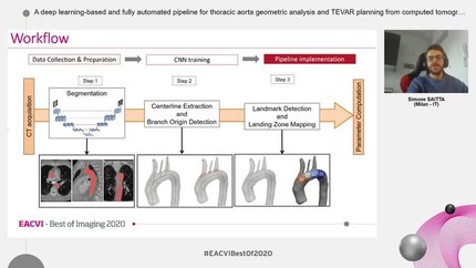 A deep learning-based and fully automated pipeline for thoracic aorta geometric analysis and TEVAR planning from computed tomography