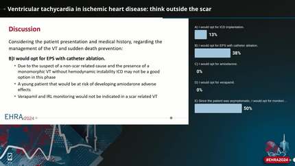 Ventricular tachycardia in ischemic heart disease: think outside the scar