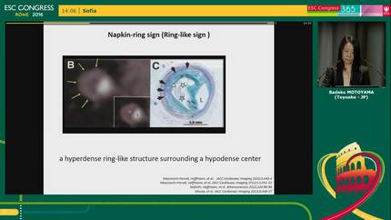 Presentation thumbnail