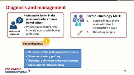 Multimodality imaging and multidisciplinary management of a rapidly growing pulmonary artery mass: a diagnostic and therapeutic challenge