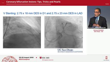 Coronary bifurcation lesions: Tips, Tricks and Pearls