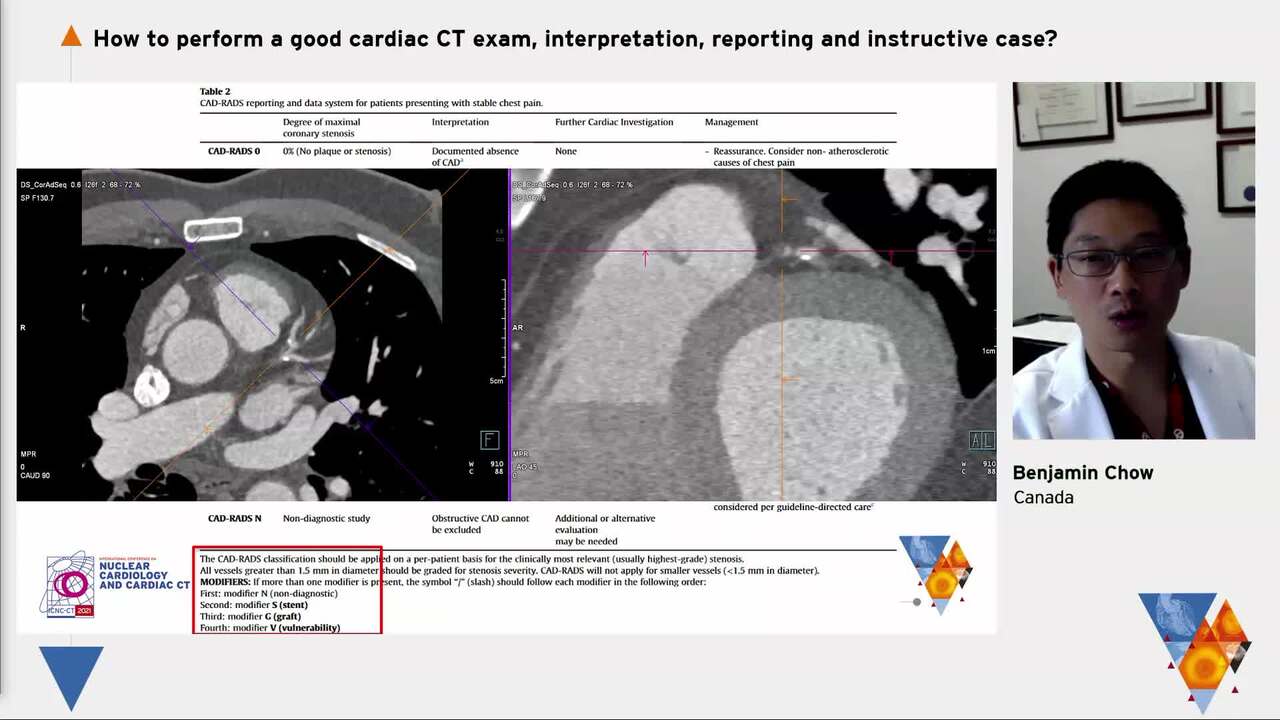 How to perform a good cardiac CT exam, interpretation, reporting and instructive case?