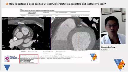 How to perform a good cardiac CT exam, interpretation, reporting and instructive case?