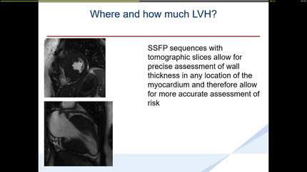 Presentation thumbnail
