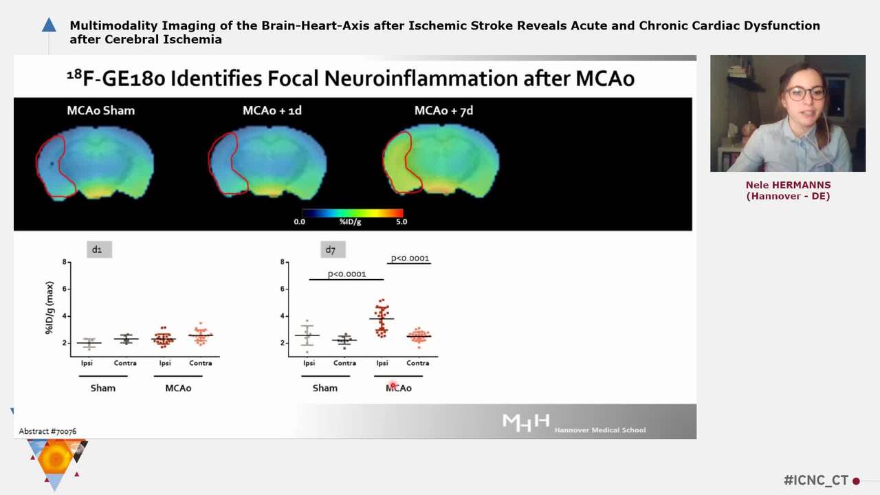 Multimodality Imaging of the Brain-Heart-Axis after Ischemic Stroke Reveals Acute and Chronic Cardiac Dysfunction after Cerebral Ischemia