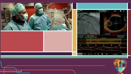 Imaging guided PCI - Live in the box