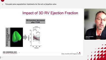 Tricuspid valve regurgitation: treatments for the not so forgotten valve