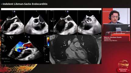 Presentation thumbnail