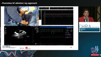 Live-in-the-Box: ablation without fluoroscopy