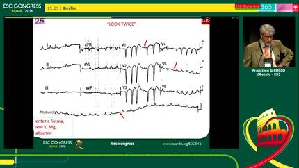 Surface ECG: a gold mine - State of the art