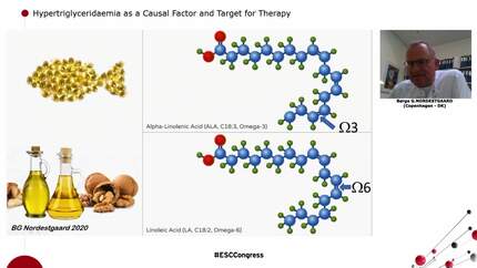 Clinical Update on Managing Hypertriglyceridaemia  with Omega-3 Fatty Acid Icosapent Ethyl