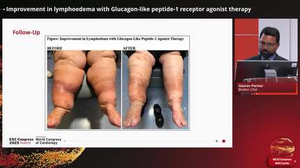 Presentation thumbnail