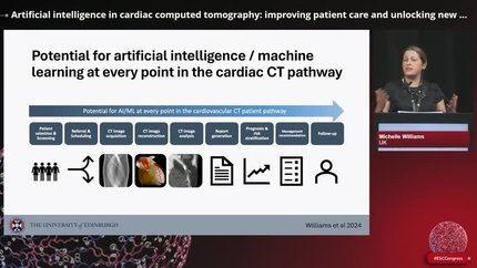 Clinical impact of artificial intelligence in cardiac imaging: cardiology and radiology perspective