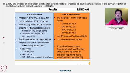 High-power Short-duration Radiofrequency Ablation for Atrial