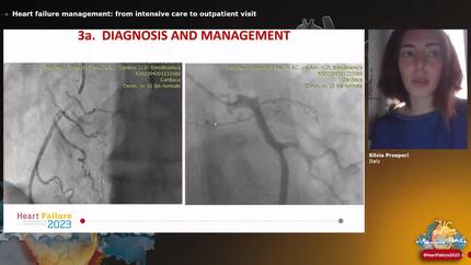 Heart failure management: from intensive care to outpatient visit
